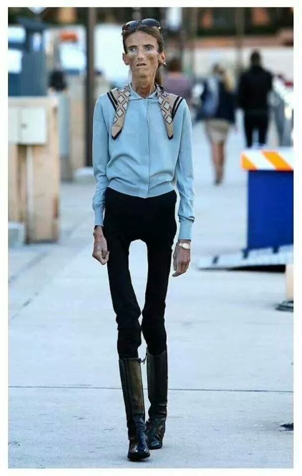 과도한 다이어트의 폐해 | 인스티즈