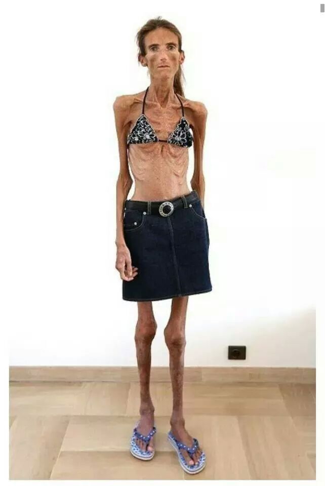 과도한 다이어트의 폐해 | 인스티즈