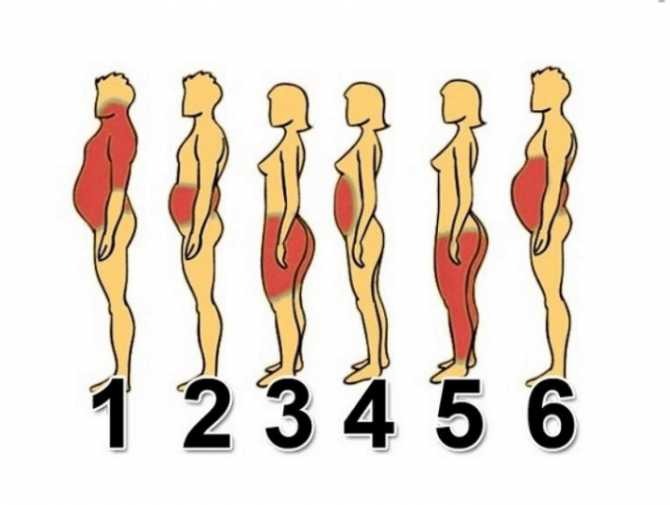 체형별 비만 유형.jpg | 인스티즈