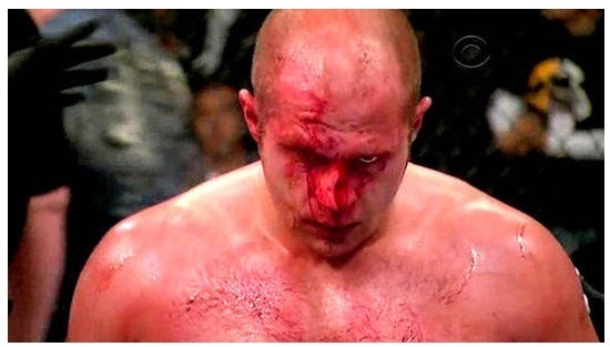 전자팀 vs 후자팀 5:5 맞짱 승자를 고르시오 .jpg | 인스티즈