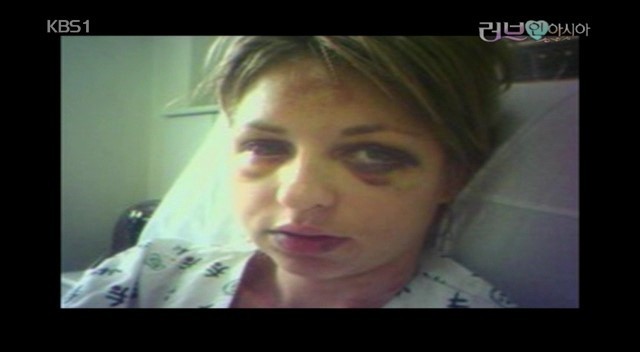 성폭행 미수 피해 외국여성이 한국에서 당한 모욕 | 인스티즈