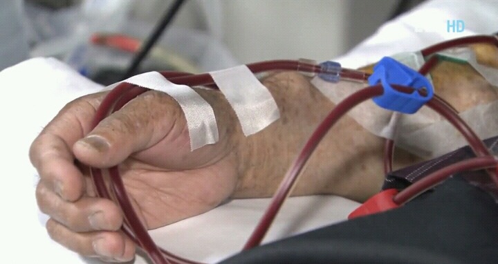 신장병을 초기에 아는 것은 아주 중요하다.jpg | 인스티즈