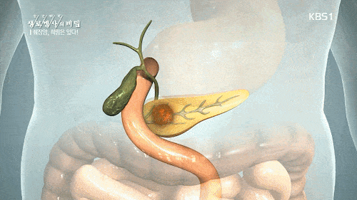 암중에 가장 무서운 암 | 인스티즈