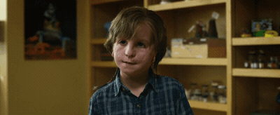 얼굴 기형인 아들이 학교에서 왕따를 당하는것 같아요...gif | 인스티즈