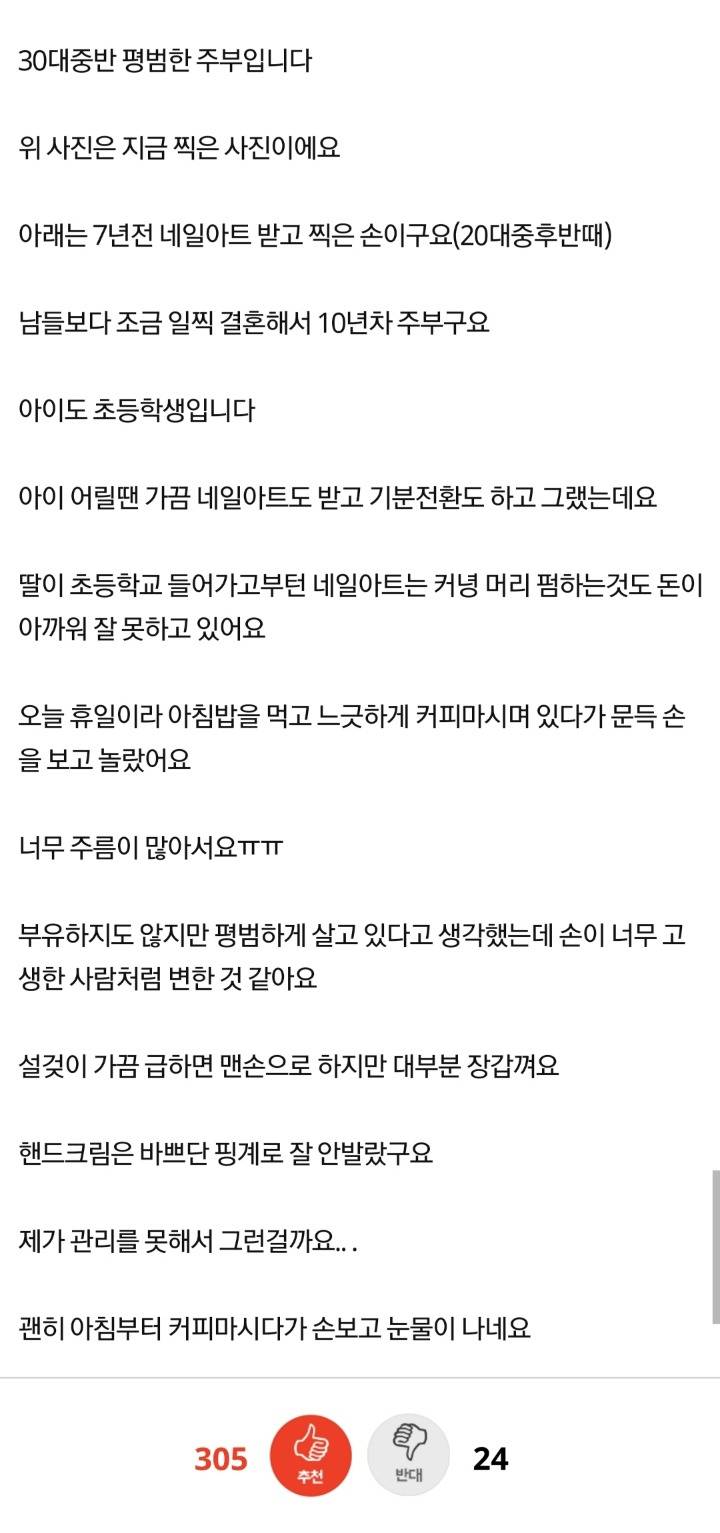 제 손을 보고 갑자기 슬퍼져서 눈물이 나네요 | 인스티즈