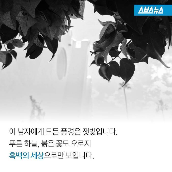  스스로 사이보그가 된 남자 | 인스티즈