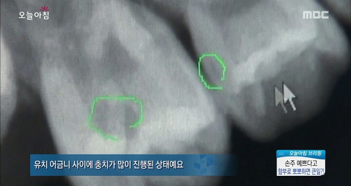 아이에게 뽀뽀하지 마세요!! | 인스티즈