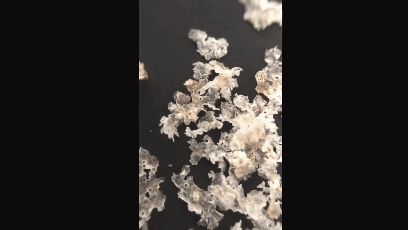 혐주의)비듬제거.GIF | 인스티즈