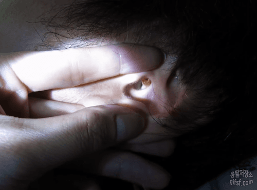 혐주의) 귀지 제거 | 인스티즈