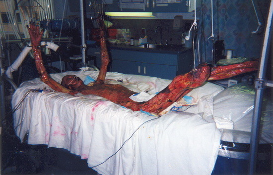 핵 그리고 방사능 피해자들 | 인스티즈