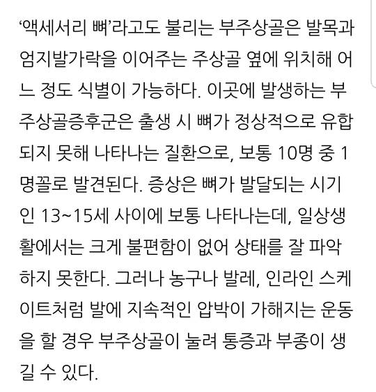 혹시 복사뼈밑에 뼈가 하나 더 튀어나와있어? 그거슨 -부주상골 증후군 | 인스티즈