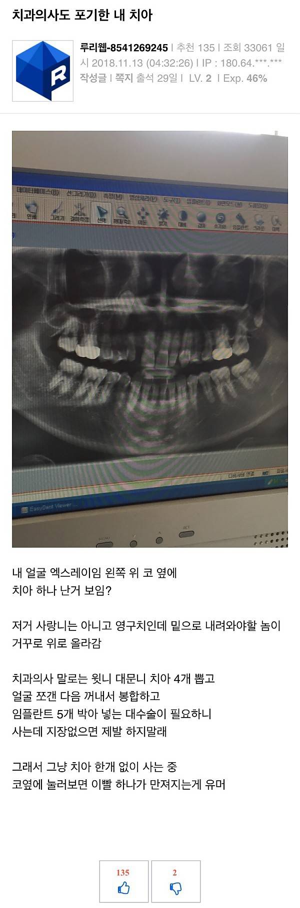 치과의사도 포기한 내 치아 | 인스티즈