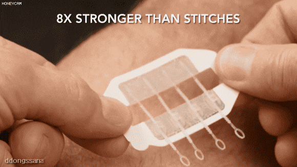 케이블 타이 원리의 상처 봉합술.gif | 인스티즈