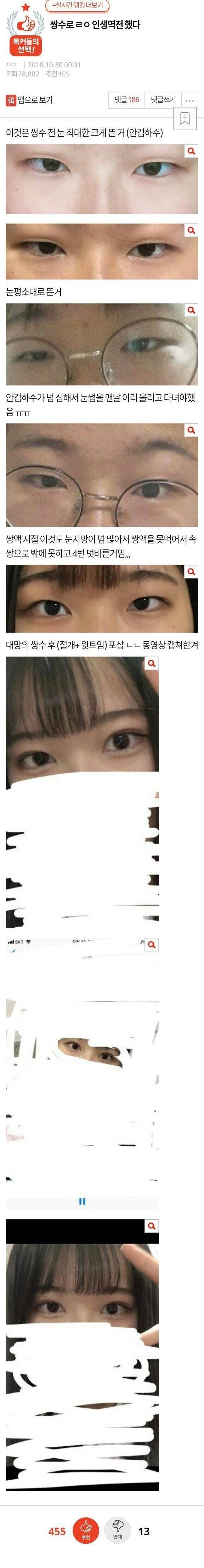 쌍수로 인생역전한 판녀.jpg | 인스티즈