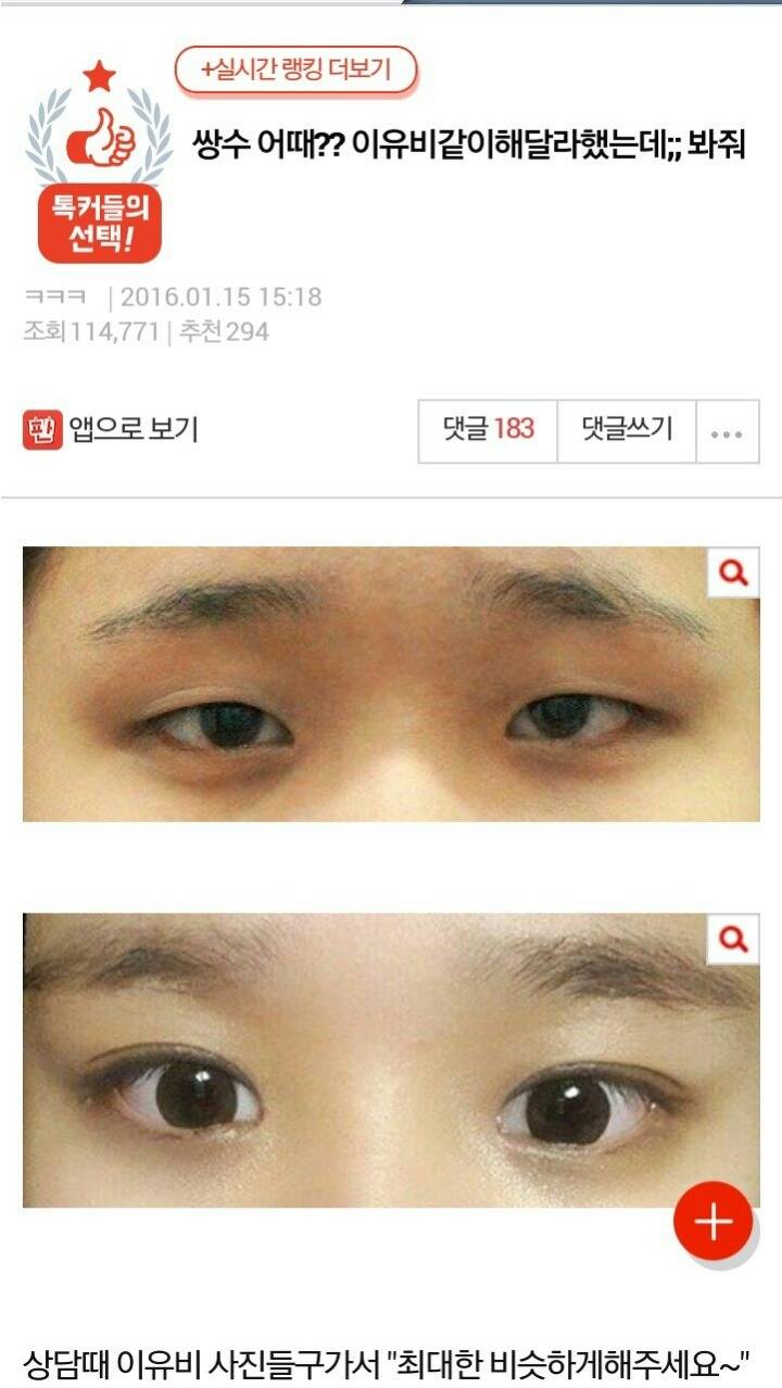 이유비같이 쌍수해달라한 판녀 | 인스티즈