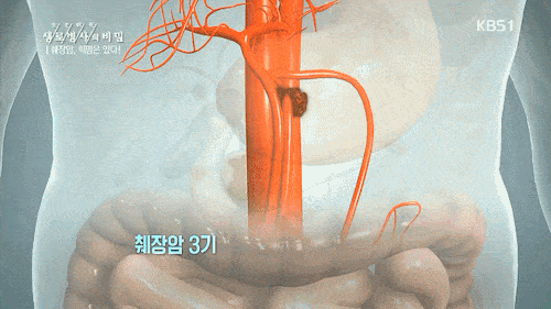 암중에 가장 무서운 암 | 인스티즈