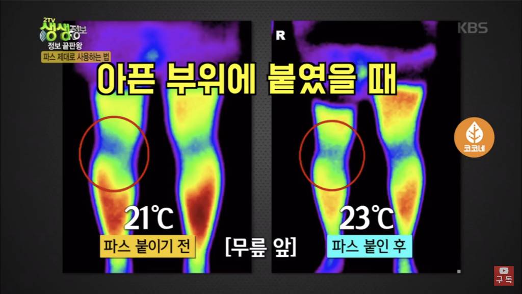 파스 제대로 붙이는 방법.jpg | 인스티즈