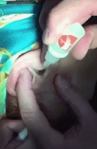 귀에 들어있는 지네 쫓아내기 | 인스티즈