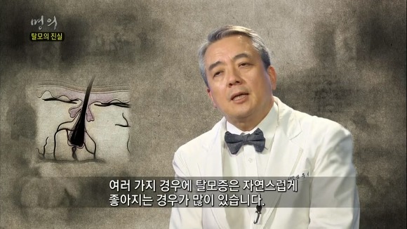 탈모의 진실 | 인스티즈