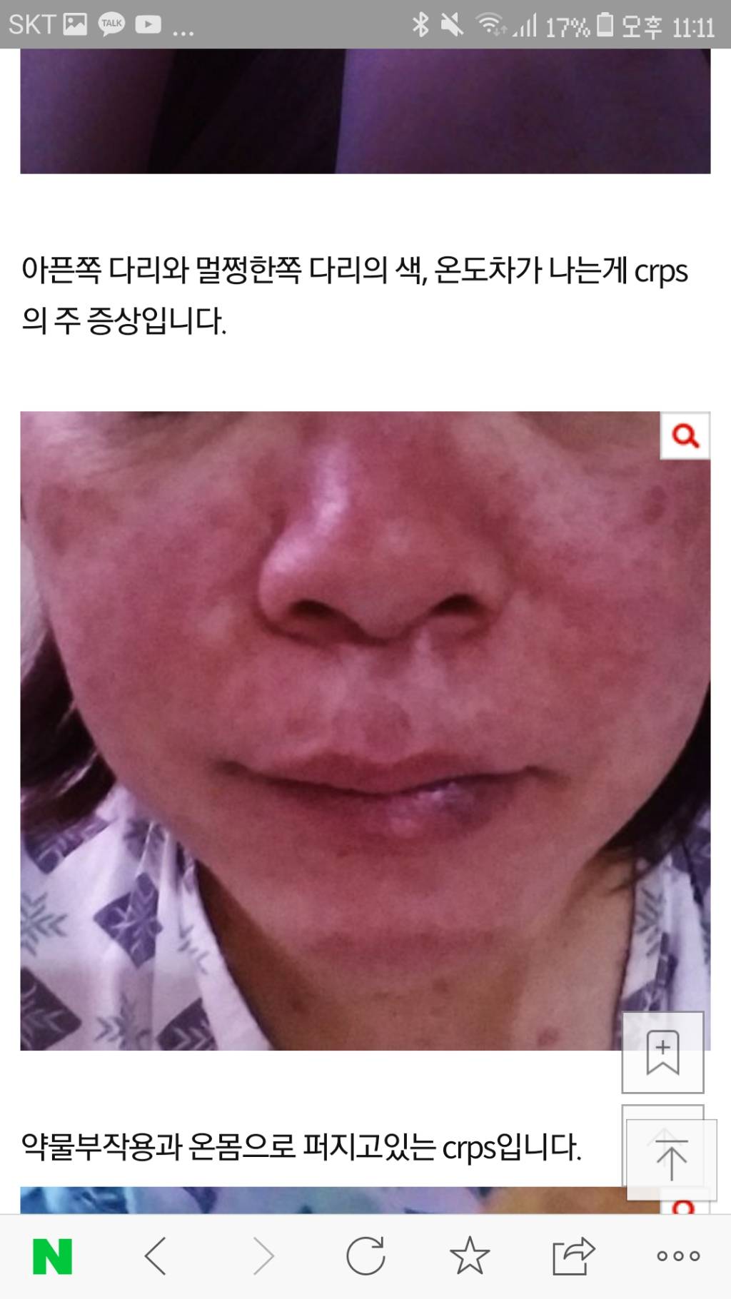 어머니께서 세상에서 가장 고통스러운 병(CRPS) 투병중입니다 | 인스티즈