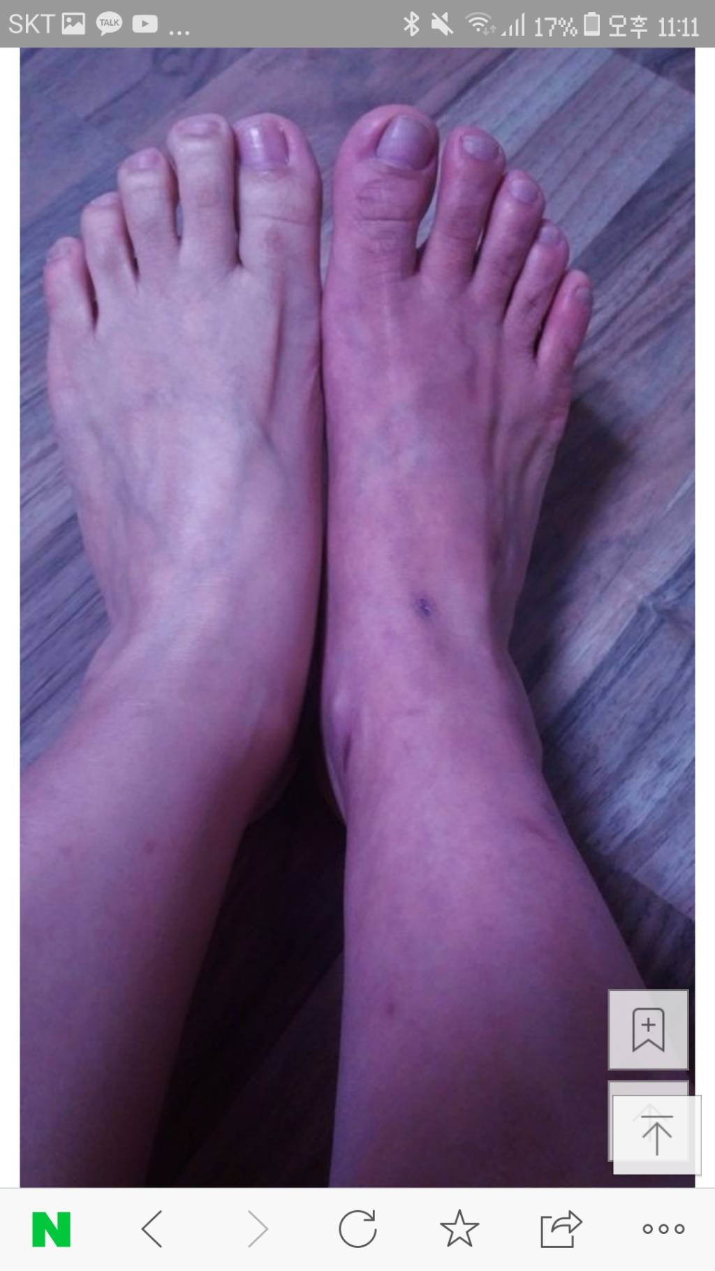 어머니께서 세상에서 가장 고통스러운 병(CRPS) 투병중입니다 | 인스티즈