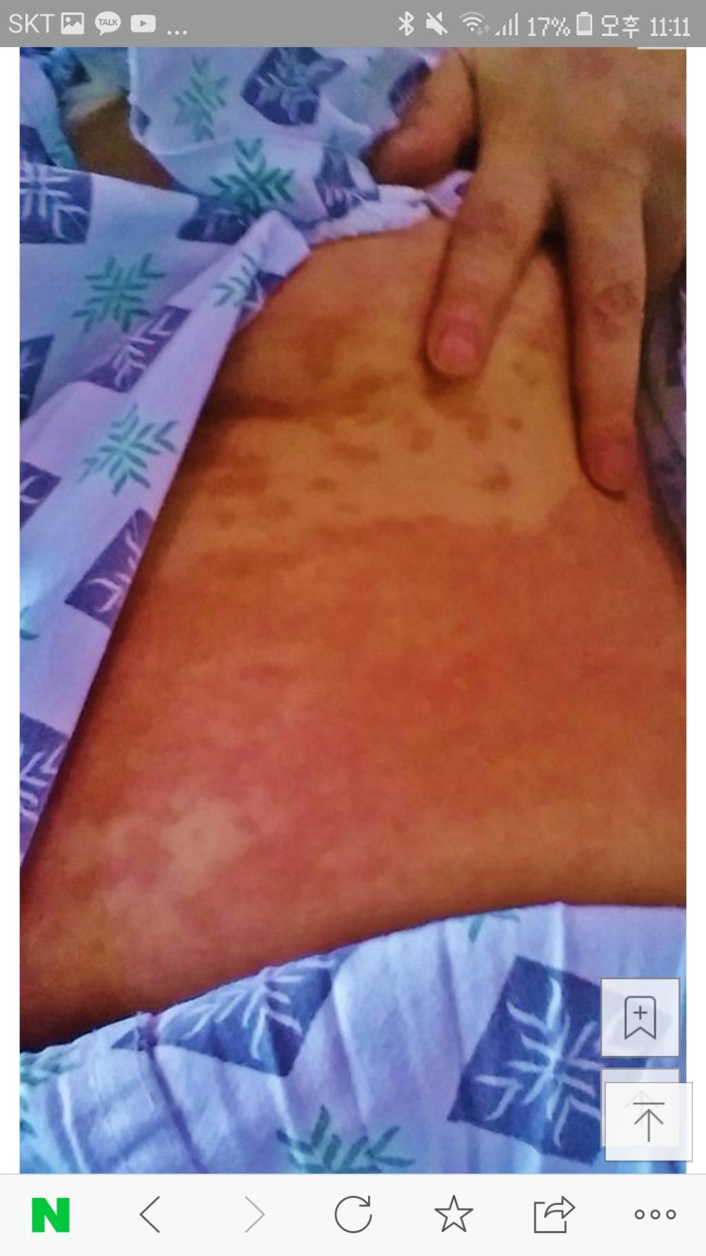 어머니께서 세상에서 가장 고통스러운 병(CRPS) 투병중입니다 | 인스티즈