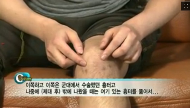 군복무하다 다리를 못쓰게 됐는데 나몰라라 하는 군대 | 인스티즈