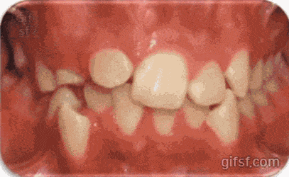 치아교정과의 위대함 | 인스티즈