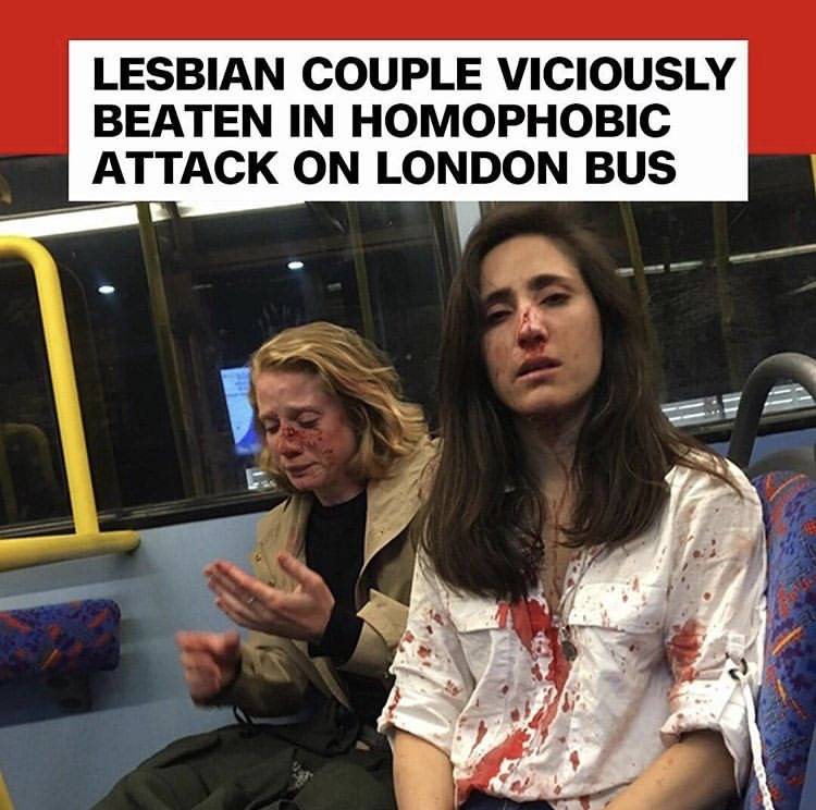 런던 버스에서 폭행당한 레즈비언 커플 (혐오주의) | 인스티즈