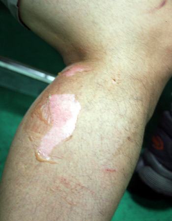 경찰이 사용하는 최루액의 진실 | 인스티즈