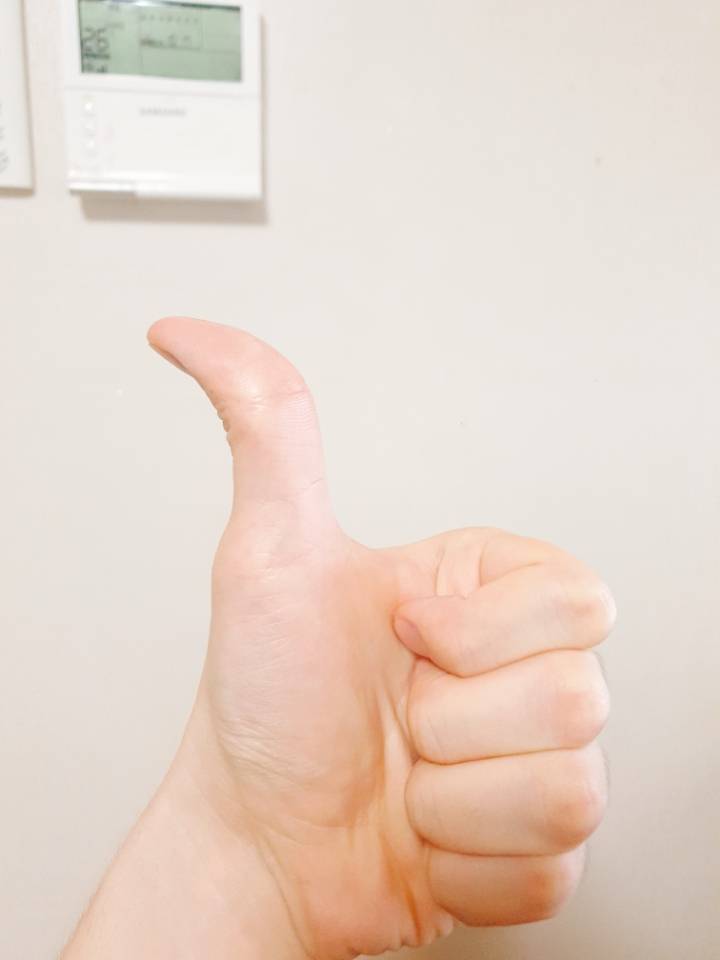 생각보다 적은 사람들이 가지고 있는 유전형질 | 인스티즈