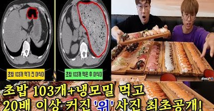 초밥 103개/냉모밀 먹은 '위' 사진 최초공개! '위'에 근육이 있다구?? 야식이 먹방