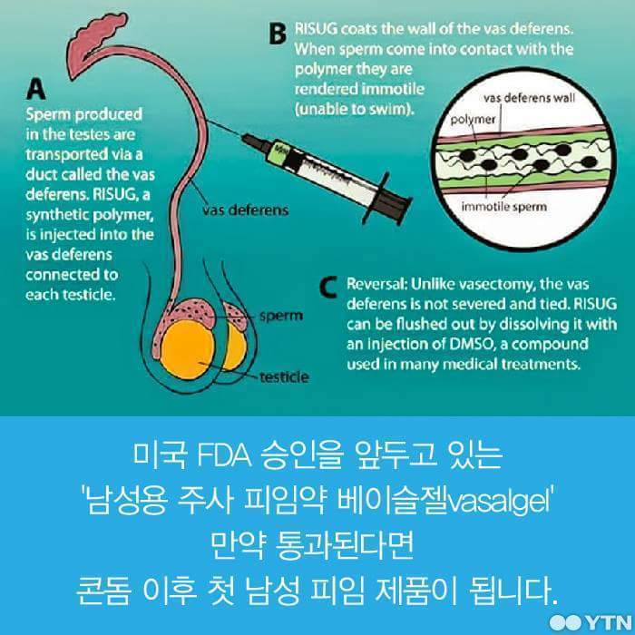피임약 이제는 남자가 먹어야 할때 | 인스티즈