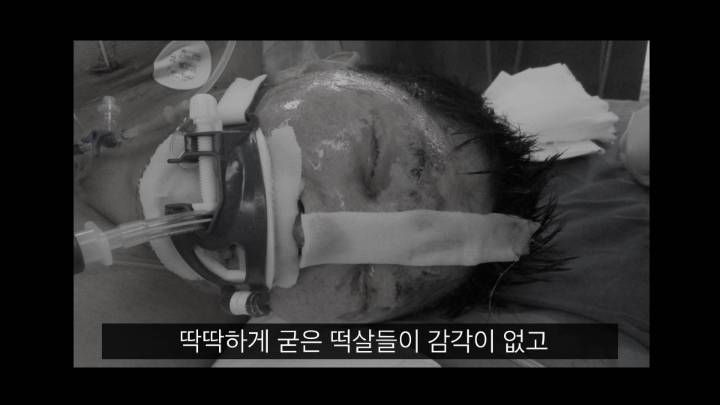 폭발사고를당하고 이상한능력이 생긴남자 | 인스티즈