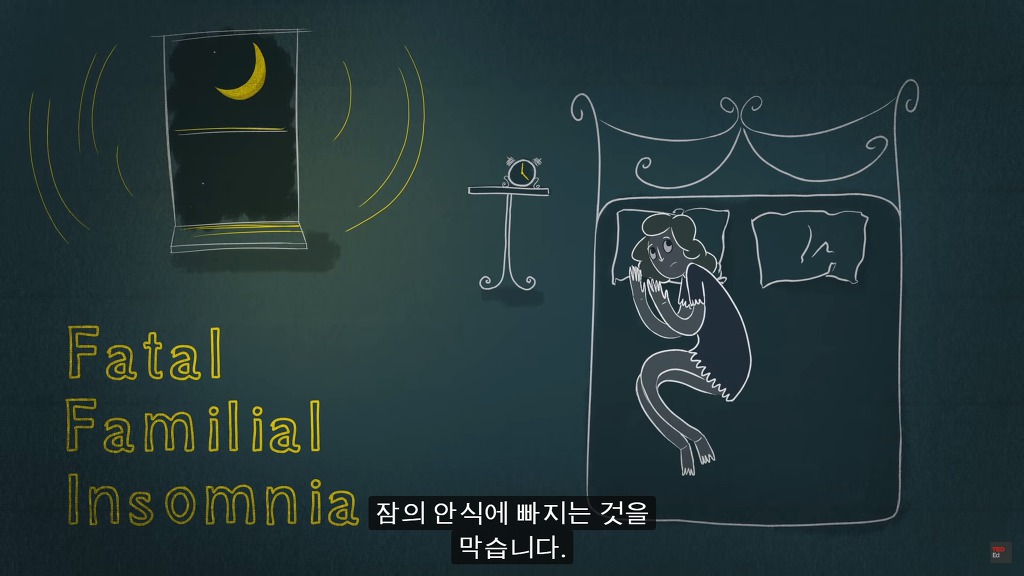 잠을 자지않는다면 우리몸에 어떠한 변화가 일어날까?.JPG | 인스티즈