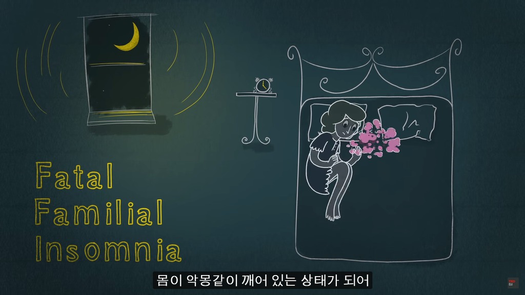 잠을 자지않는다면 우리몸에 어떠한 변화가 일어날까?.JPG | 인스티즈