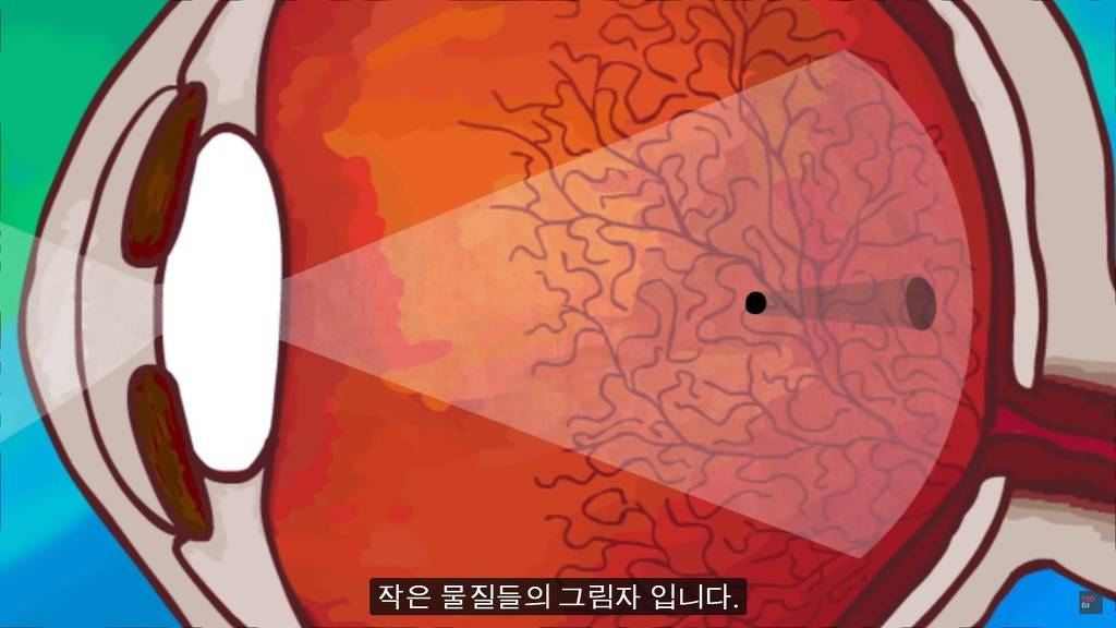 여러분의 눈에 둥둥 떠다니는 그것들은 무엇일까요? | 인스티즈