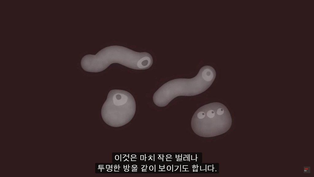 여러분의 눈에 둥둥 떠다니는 그것들은 무엇일까요? | 인스티즈