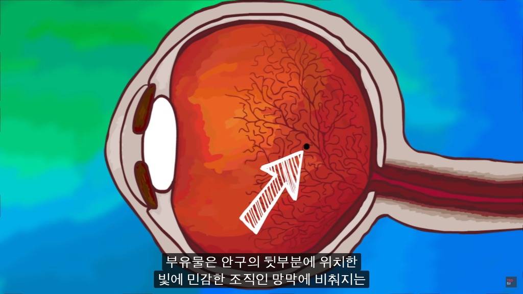 여러분의 눈에 둥둥 떠다니는 그것들은 무엇일까요? | 인스티즈