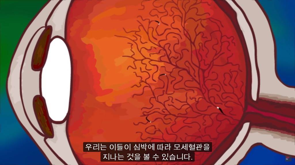 여러분의 눈에 둥둥 떠다니는 그것들은 무엇일까요? | 인스티즈