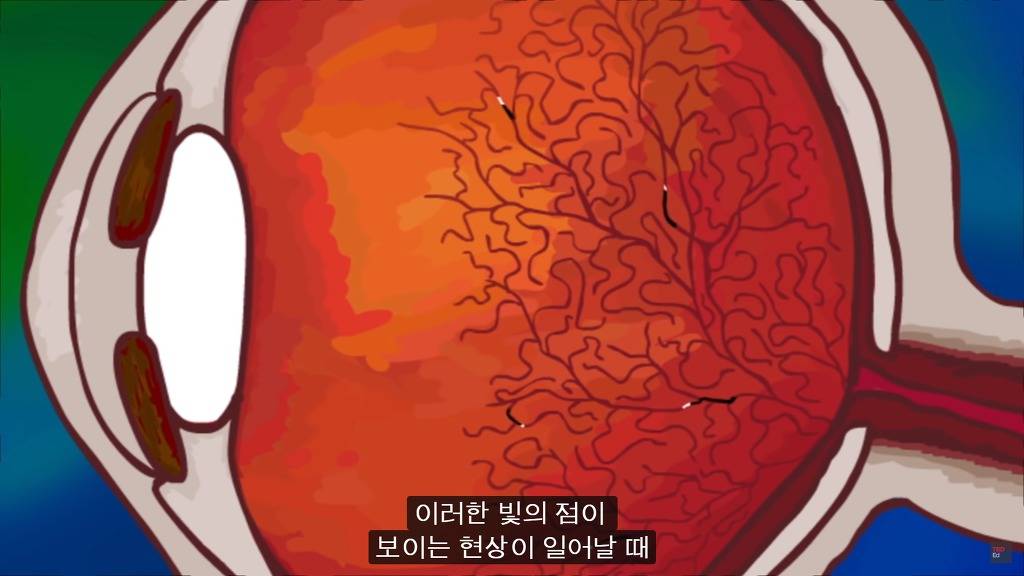 여러분의 눈에 둥둥 떠다니는 그것들은 무엇일까요? | 인스티즈