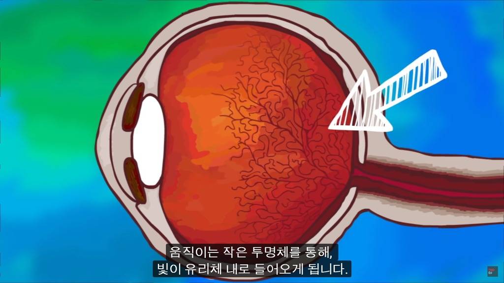 여러분의 눈에 둥둥 떠다니는 그것들은 무엇일까요? | 인스티즈