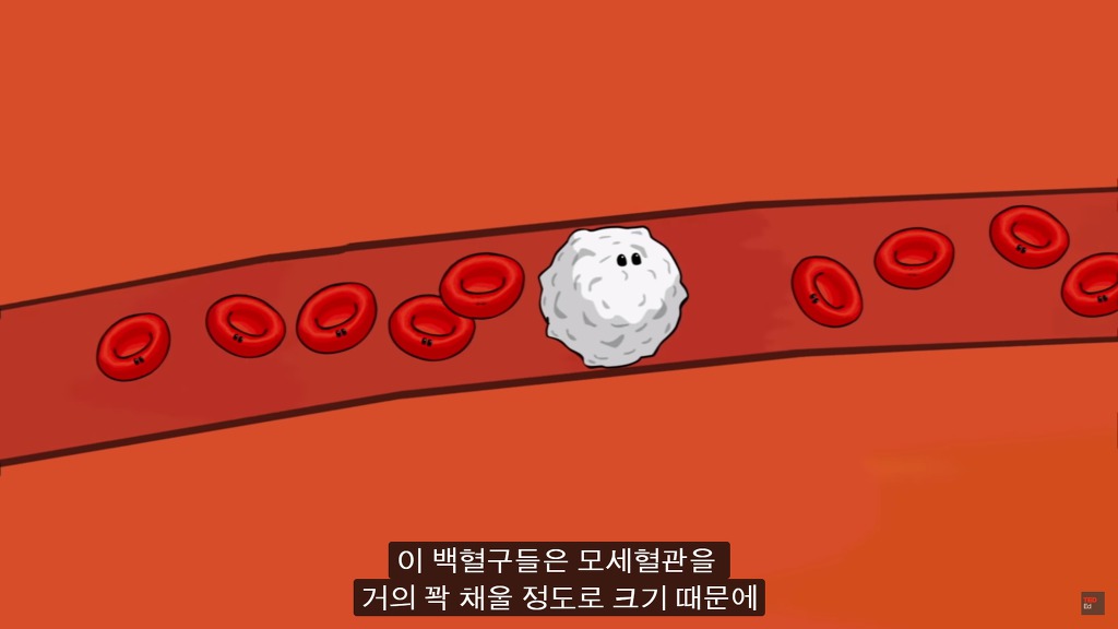 여러분의 눈에 둥둥 떠다니는 그것들은 무엇일까요? | 인스티즈