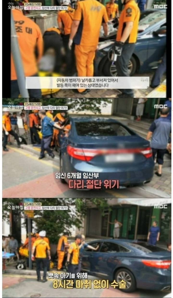 아기를 위해 마취 없이 8시간 수술을 받은 임산부.jpg | 인스티즈