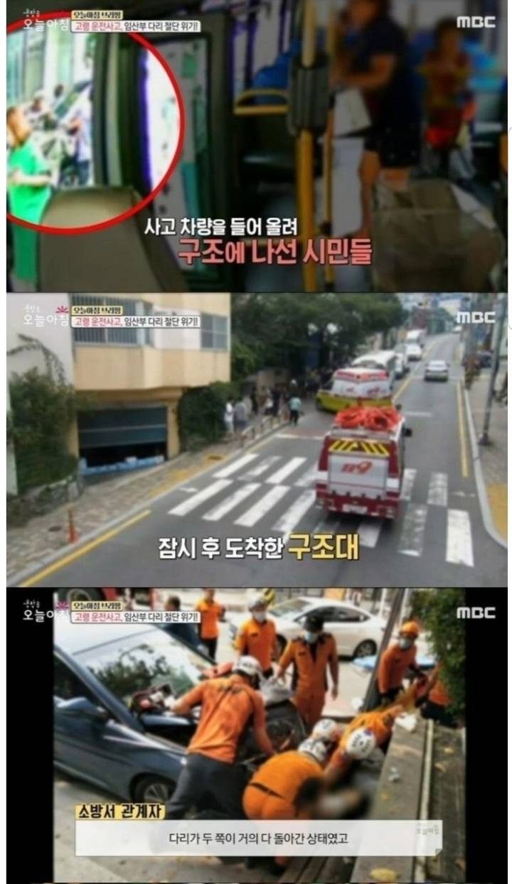 아기를 위해 마취 없이 8시간 수술을 받은 임산부.jpg | 인스티즈