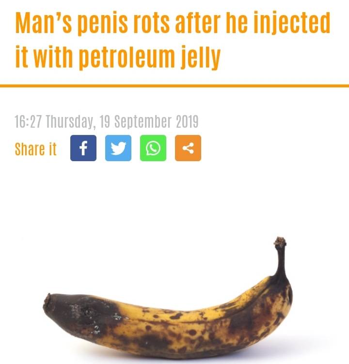 어떤 한 45세 남자는 꼬추를 키우고 싶어서 꼬추에 바셀린을 주입했다가 썩어버림... | 인스티즈