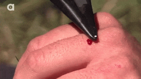 고통도 없고 겁도없는 디스커버리 동물 전문가.jpgif | 인스티즈