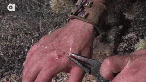 고통도 없고 겁도없는 디스커버리 동물 전문가.jpgif | 인스티즈