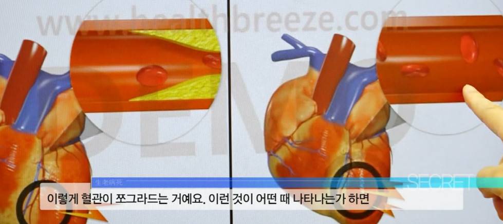 담배는 끊었지만 술의 유혹에서 벗어나지 못하는 58살 남성의 음주 습관 | 인스티즈