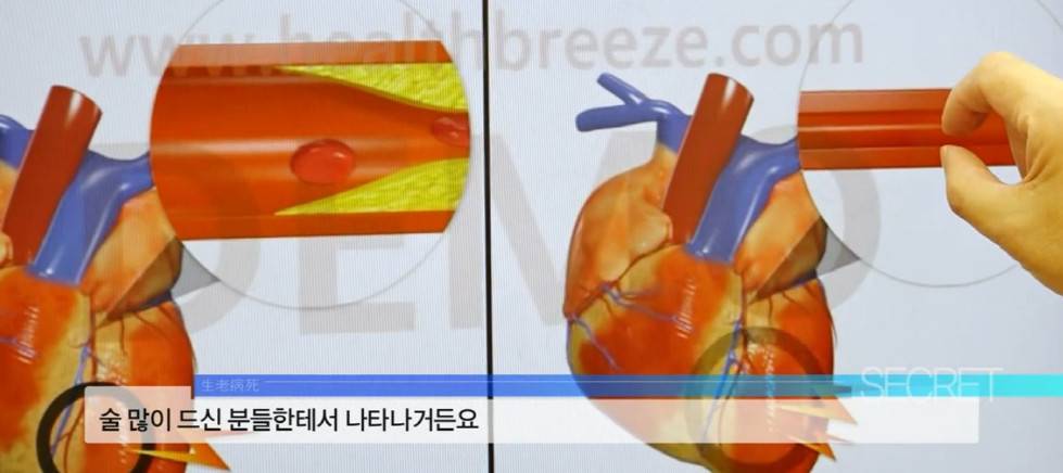 담배는 끊었지만 술의 유혹에서 벗어나지 못하는 58살 남성의 음주 습관 | 인스티즈